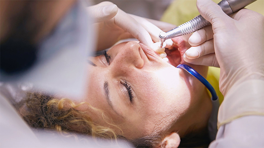 Igiene dentale e sbiancamento